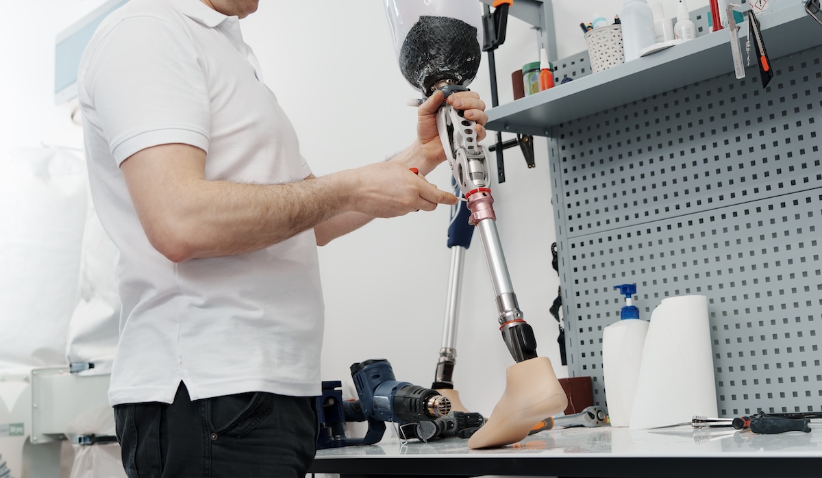 Steuerberatung im Handwerk für Orthopädietechnik-Betriebe durch die Steuerkanzlei Kettwig Orthopädietechnik-Mechaniker bei der Anpassung einer Beinprothese als Beispiel für einen Handwerksbetrieb